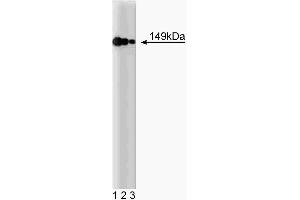 Western blot analysis of AKAP149 on a HeLa cell lysate (Human cervical epitheloid carcinoma, ATCC CCL-2. (AKAP1 anticorps  (AA 66-212))