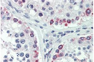 Human Testis: Formalin-Fixed, Paraffin-Embedded (FFPE)