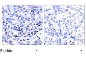 Image no. 1 for anti-Nuclear Factor of kappa Light Polypeptide Gene Enhancer in B-Cells 1 (NFKB1) (Ser337) antibody (ABIN197123) (NFKB1 anticorps  (Ser337))