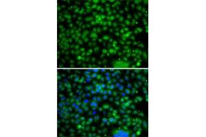Immunofluorescence analysis of A-549 cells using PHYHD1 antibody (ABIN6133210, ABIN6145585, ABIN6145586 and ABIN6223037). (PHYHD1 anticorps  (AA 1-291))