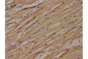 IHC image of ABIN7139912 diluted at 1:100 and staining in paraffin-embedded human heart tissue performed on a Leica BondTM system. (LPAR3 anticorps  (AA 312-330))