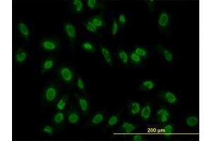 Image no. 2 for anti-TATA Box Binding Protein Associated Factor 11 (TAF11) (AA 158-211) antibody (ABIN598955) (TAF11 anticorps  (AA 158-211))
