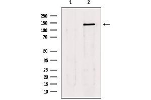 Western blot analysis of extracts from 293, using lats1/2 Antibody. (LATS1 anticorps  (Internal Region))