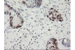 Image no. 4 for anti-Replication Factor C (Activator 1) 2, 40kDa (RFC2) (AA 1-234) antibody (ABIN1490616)