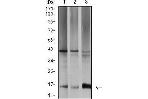 Western blot analysis using SAG2 mouse mAb against SW480 (1), A431 (2), and K562 (3) cell lysate. (Surface Antigen 2B anticorps  (AA 1-130))