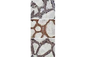 Immunohistochemistry staining of mouse mammary gland samples from lactating mice (L10) with Eif2ak3 polyclonal antibody . (PERK anticorps  (AA 601-1115))