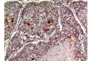Immunohistochemistry (IHC) analysis of paraffin-embedded Human Lung, antibody was diluted at 1:100.