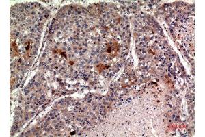 Immunohistochemistry (IHC) analysis of paraffin-embedded Human Lung, antibody was diluted at 1:100. (RANKL anticorps  (C-Term))