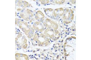Immunohistochemistry of paraffin-embedded human stomach using OPA3 antibody (ABIN5975243) at dilution of 1/100 (40x lens). (OPA3 anticorps)