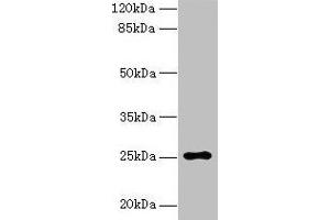 Western blot All lanes: ARPIN antibody at 0. (ARPIN anticorps  (AA 1-226))