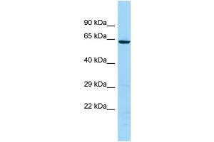 WB Suggested Anti-KRT74 Antibody Titration: 1.