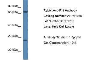 Western Blotting (WB) image for anti-Coagulation Factor XI (F11) (C-Term) antibody (ABIN2788664) (Factor XI anticorps  (C-Term))
