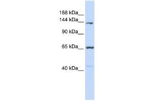 PCDH12 antibody used at 1 ug/ml to detect target protein. (PCDH12 anticorps  (Middle Region))