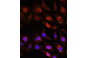 Immunofluorescence analysis of NIH/3T3 cells using ZC3H12D Rabbit pAb (ABIN7271448) at dilution of 1:100.