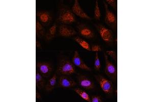 Immunofluorescence analysis of NIH/3T3 cells using ZC3H12D Rabbit pAb (ABIN7271448) at dilution of 1:100. (ZC3H12D anticorps  (AA 150-230))