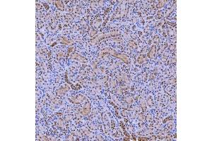 IHC analysis of SNRNP200 using anti-SNRNP200 antibody (ABIN7602032).