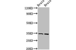 Western Blot Positive WB detected in: Mouse brain tissue, Rat brain tissue All lanes: FOXE3 antibody at 4 μg/mL Secondary Goat polyclonal to rabbit IgG at 1/50000 dilution Predicted band size: 34 kDa Observed band size: 34 kDa (FOXE3 anticorps  (AA 4-74))