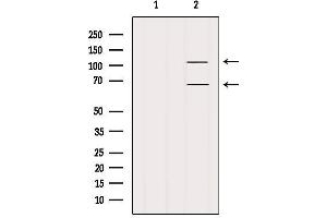 Western blot analysis of extracts from Mouse lung, using FAM65B Antibody. (FAM65B anticorps)