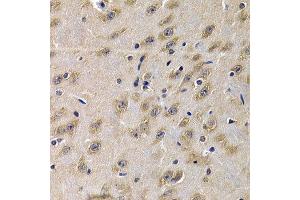 Immunohistochemistry of paraffin-embedded mouse brain using C1QA antibody at dilution of 1:200 (400x lens). (C1QA anticorps)