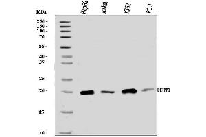 Western blot analysis of XTP3TPA/DCTPP1 using anti-XTP3TPA/DCTPP1 antibody (ABIN7600677).