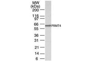 Western Blotting (WB) image for anti-Coactivator-Associated Arginine Methyltransferase 1 (CARM1) (AA 45-69) antibody (ABIN208355) (CARM1 anticorps  (AA 45-69))