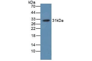 Detection of HB in HB, Simian using Polyclonal Antibody to Hemoglobin (HB) (Hemoglobin anticorps)