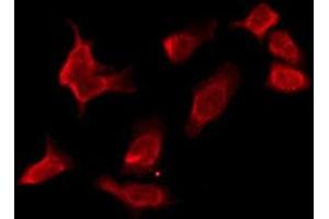 ABIN6276115 staining HuvEc by IF/ICC.