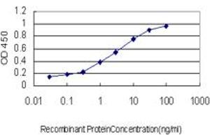 Detection limit for recombinant GST tagged CTNNBIP1 is approximately 0. (CTNNBIP1 anticorps  (AA 1-81))