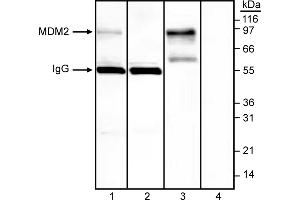 Western Blotting (WB) image for anti-Mdm2, p53 E3 Ubiquitin Protein Ligase Homolog (Mouse) (MDM2) (AA 154-167) antibody (ABIN967511)