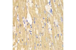 Immunohistochemistry of paraffin-embedded mouse heart using CAPN1 antibody at dilution of 1:100 (400x lens). (CAPNL1 anticorps)