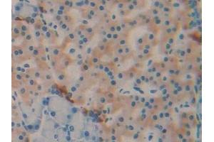 Detection of DBP in Rat Pancreas Tissue using Monoclonal Antibody to Vitamin D Binding Protein (DBP) (Vitamin D-Binding Protein anticorps  (AA 209-394))