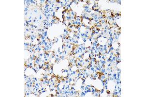 Immunohistochemistry of paraffin-embedded rat lung using Alpha-2-Macroglobulin (Alpha-2-Macroglobulin (M)) Rabbit mAb (ABIN7265558) at dilution of 1:100 (40x lens).