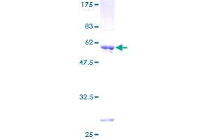 Image no. 1 for Deoxyguanosine Kinase (DGUOK) (AA 1-277) protein (GST tag) (ABIN1351525)