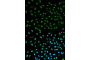 Immunofluorescence analysis of MCF7 cell using DDB2 antibody. (DDB2 anticorps)