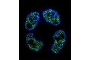 anti-Frequently Rearranged in Advanced T-Cell Lymphomas 2 (FRAT2) (AA 210-233), (C-Term) antibody