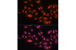 Immunofluorescence analysis of U2OS cells using MB/MB/ML2 antibody (ABIN6132319, ABIN6143422, ABIN6143424 and ABIN6216232) at dilution of 1:100.