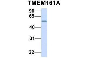 Host:  Rabbit  Target Name:  TMEM161A  Sample Type:  Human Fetal Heart  Antibody Dilution:  1. (TMEM161A anticorps  (Middle Region))