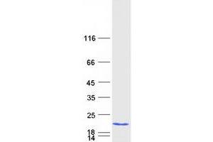 Validation with Western Blot
