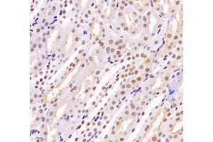 Immunohistochemistry of paraffin embedded mouse kidney using MECOM (ABIN7074575) at dilution of 1: 2200 (400x lens) (MECOM anticorps)