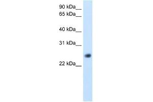 GGTLA4 antibody used at 5 ug/ml to detect target protein. (GGTLC1 anticorps  (C-Term))