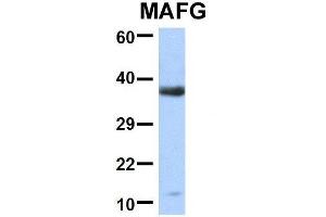 Host:  Rabbit  Target Name:  MAFG  Sample Type:  Human Fetal Brain  Antibody Dilution:  1.
