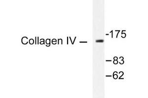 Image no. 1 for anti-Collagen, Type IV (COL4) antibody (ABIN265367) (Collagen IV anticorps)
