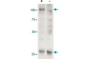 Cell line 143B overexpressing human AARS2 and probed with AARS2 polyclonal antibody  (mock transfection in second lane). (AARS2 anticorps  (AA 478-489))