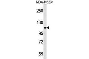 ACTN3 Antibody (Center) western blot analysis in MDA-MB231 cell line lysates (35µg/lane). (ACTN3 anticorps  (Middle Region))