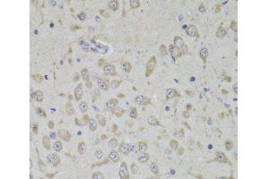 Immunohistochemistry of paraffin-embedded Mouse brain using RPL3 Polyclonal Antibody at dilution of 1:100 (40x lens). (RPL3 anticorps)