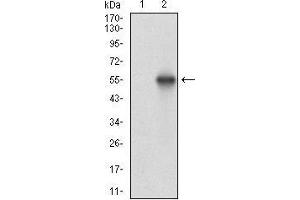 Fig. (CSNK2B anticorps  (AA 1-215))