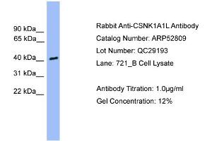 WB Suggested Anti-CSNK1A1L  Antibody Titration: 0. (CSNK1A1L anticorps  (Middle Region))