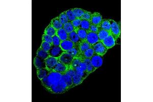 Confocal immunofluorescent analysis of C1QC Antibody (Center) (ABIN655873 and ABIN2845277) with WiDr cell followed by Alexa Fluor?