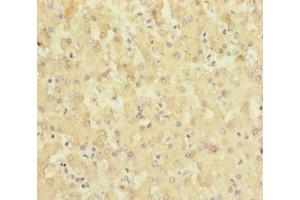 Immunohistochemistry of paraffin-embedded human liver tissue using ABIN7169946 at dilution of 1:100 (SLC6A12 anticorps  (AA 515-614))