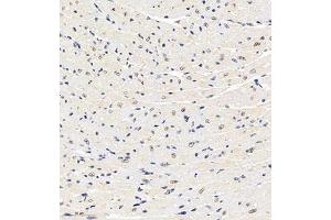 Immunohistochemistry of paraffin embedded mouse heart using HDAC (ABIN7074234) at dilution of 1:1200 (300x lens)